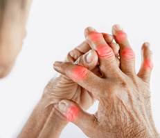Roanoke Arthritis Treatment